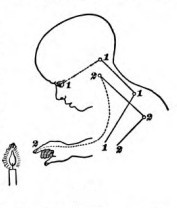 On “The Education of the Hemispheres”. Why “the burnt child dreads the&nbsp;fire.”